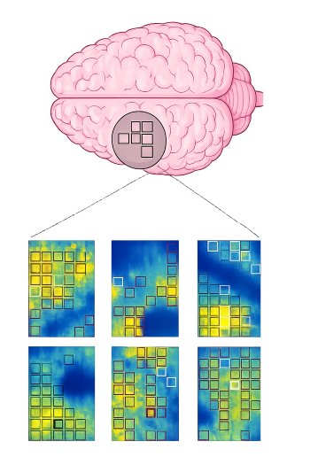 Structured illumination application illustration